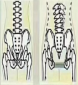 青島產(chǎn)后修復(fù)